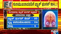 Bengaluru Reports Over 200 Black Fungus Cases..! What Are The Symptoms Of Black Fungus Infection..?