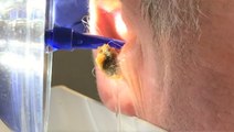 This water device painlessly removes earwax