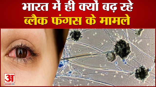 विशेषज्ञों ने बताया इस गलती से बढ़ रहे हैं ब्लैक फंगस के केस | Black Fungus Cases Increases in India