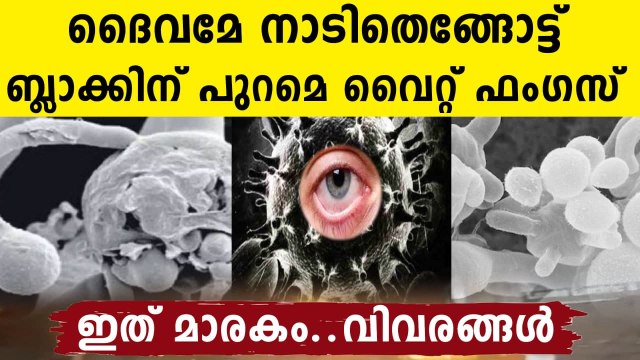After black fungus, white fungus infection cases reported in India