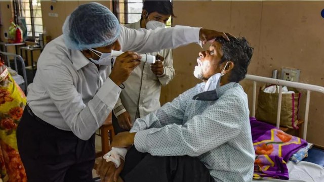 India faces black fungus epidemic as cases increase