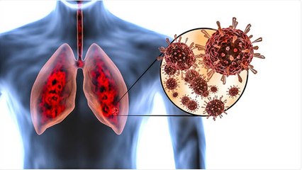 Corona से ठीक होने के बाद Lungs का रखें खास ख्याल, 6 Month बाद भी हो सकती है यह समस्या । Boldsky