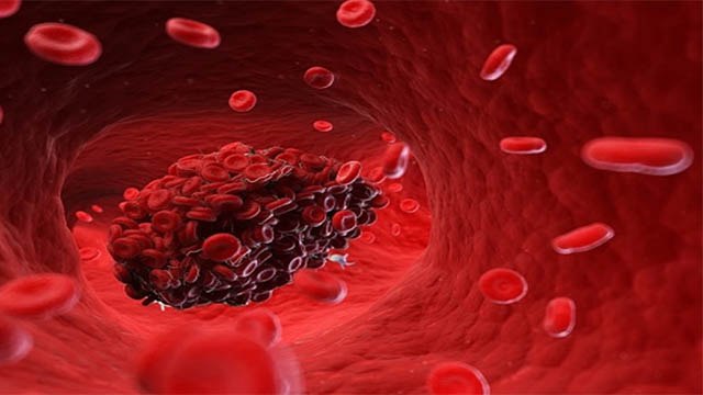 Corona Vaccine लगवाने के बाद इस वजह से हो रही Blood clotting | Boldsky