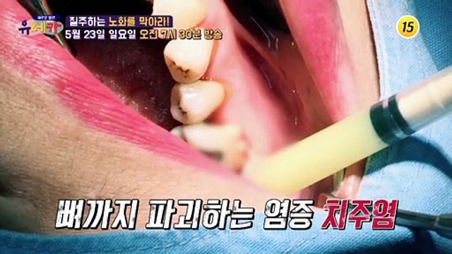 질주하는 노화를 막아라! 내 몸의 안전밸트 콜라겐_새로운 발견 유레카 16회 예고 TV CHOSUN 210523 방송