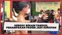 Heboh! Bekam Tanduk, Penampakan Pasien Jadi Sorotan Warganet