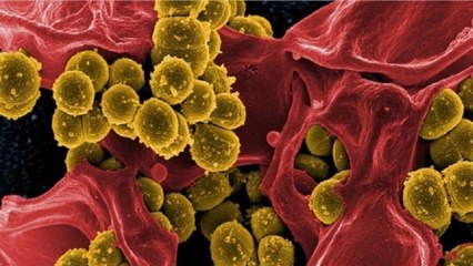 People dying of Black Fungus, is it deadlier than Corona?