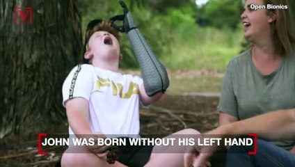 This 11-Year-Old Has a New Lease on Life with His New Bionic Arm!