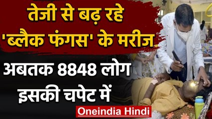 Black Fungus के मरीजों में तेजी से हो रहा इजाफा, अब तक 8,848 लोग चपेट में | वनइंडिया हिंदी