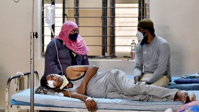 Doctors panel speaks on Black Fungus, all you need to know