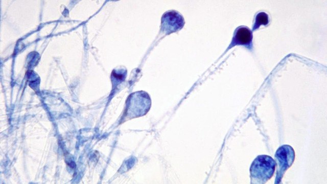 Black Fungus epidemic: Know how many cases in which states