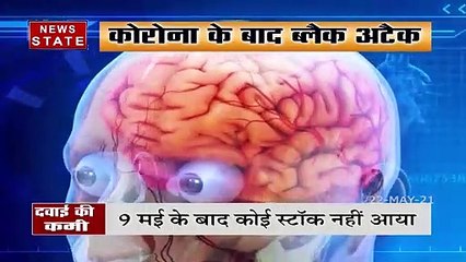 Tải video: छत्तीसगढ़ मे नहीं मिल रही ब्लैक फंगस में काम आने वाले इंजेक्शन