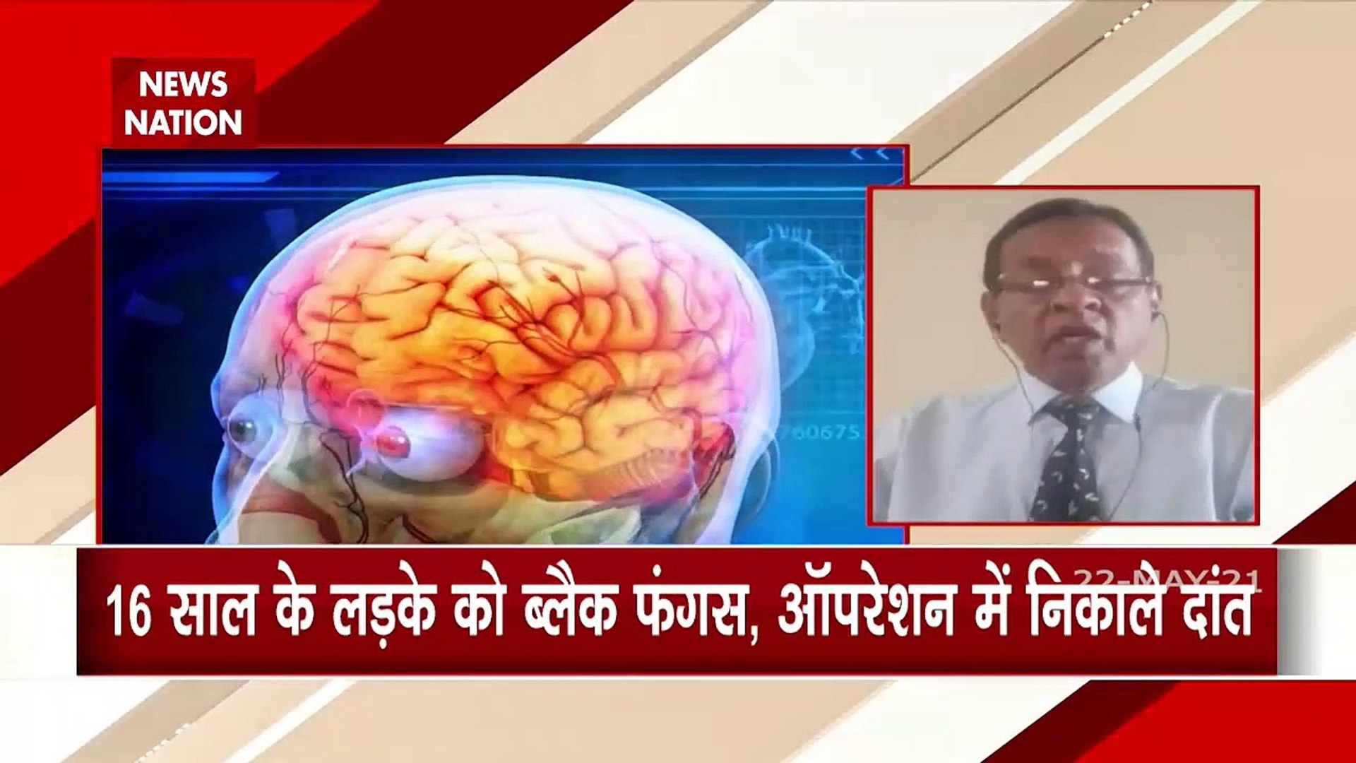 First Case Of Black Fungus In Child Know The Way Of Prevention Video Dailymotion