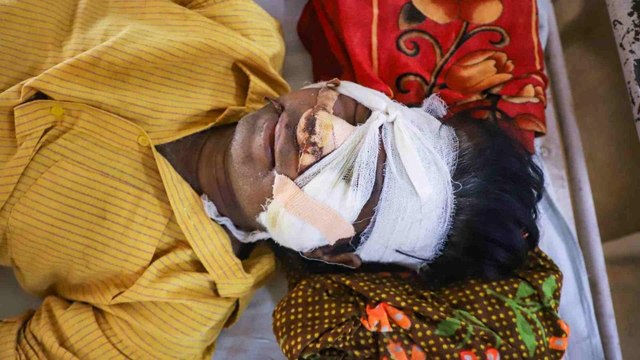 Black Fungus: A new epidemic amid the pandemic!