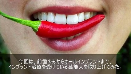 【驚愕】インプラントで真っ白な歯に治療した芸能人　5選