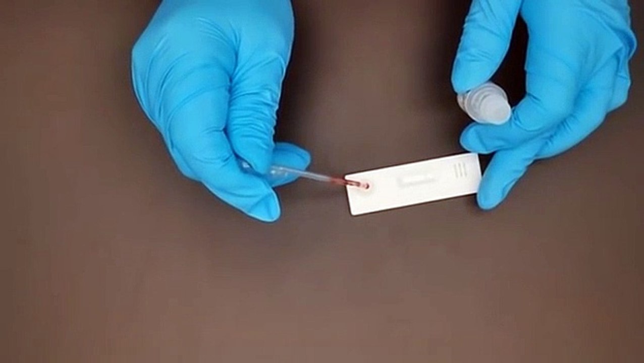 Covid-19 Igm/Igg Rapid Test Kit