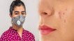 N95 Mask पहनने से निकल रहे हैं Pimples, तो ये उपाय कर सकते हैं आपकी मदद । Boldsky
