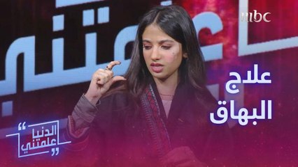 رغد عبدالله: تعرضت للتنمر بسبب البهاق