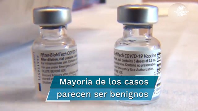 Detectan problemas cardíacos en adolescentes adultos jóvenes vacunados en EU con Pfizer