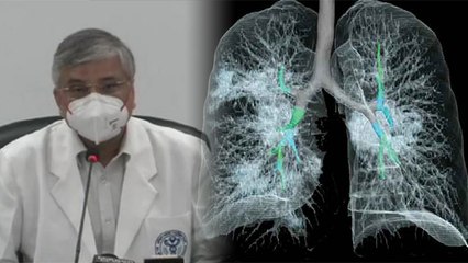 Black Fungus छूने से फैलता है या नहीं, Dr. Randeep Guleria ने बताया सच | Boldsky