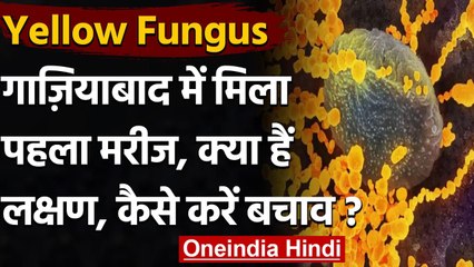 Yellow Fungus: Black and White Fungus के बाद Yellow Fungus का केस, जानें इसके लक्षण | वनइंडिया हिंदी