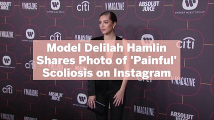 Model Delilah Hamlin Shares Photo of 'Painful' Scoliosis on Instagram