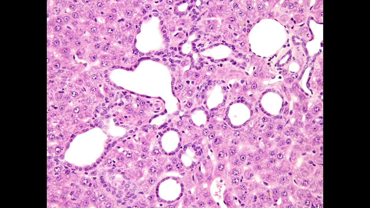21Hz Bile duct