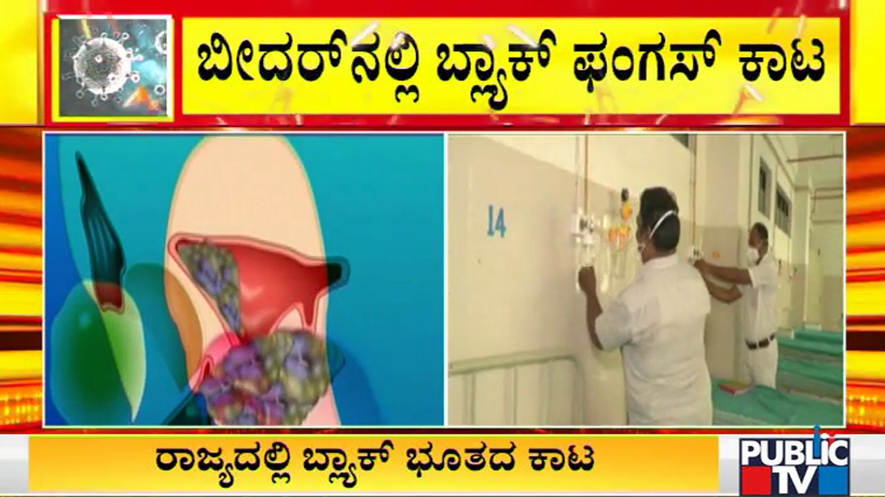 ಬ್ಲಾಕ್ ಫಂಗಸ್ ಸೋಂಕಿತರಿಗೆ ಚಿಕಿತ್ಸೆ ನೀಡಲು ಬ್ರಿಮ್ಸ್...