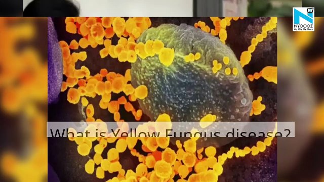 After rising cases of 'black fungus', reports over 'yellow fungus'
