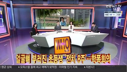 [사건큐브] 얼굴뼈 부러진 초등생 '전치 8주'…오늘 학폭회의