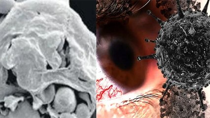 Black Fungus हो या White Fungus, इस 1 चीज  को काबू करना बेहद जरूरी है? जानिए । Boldsky