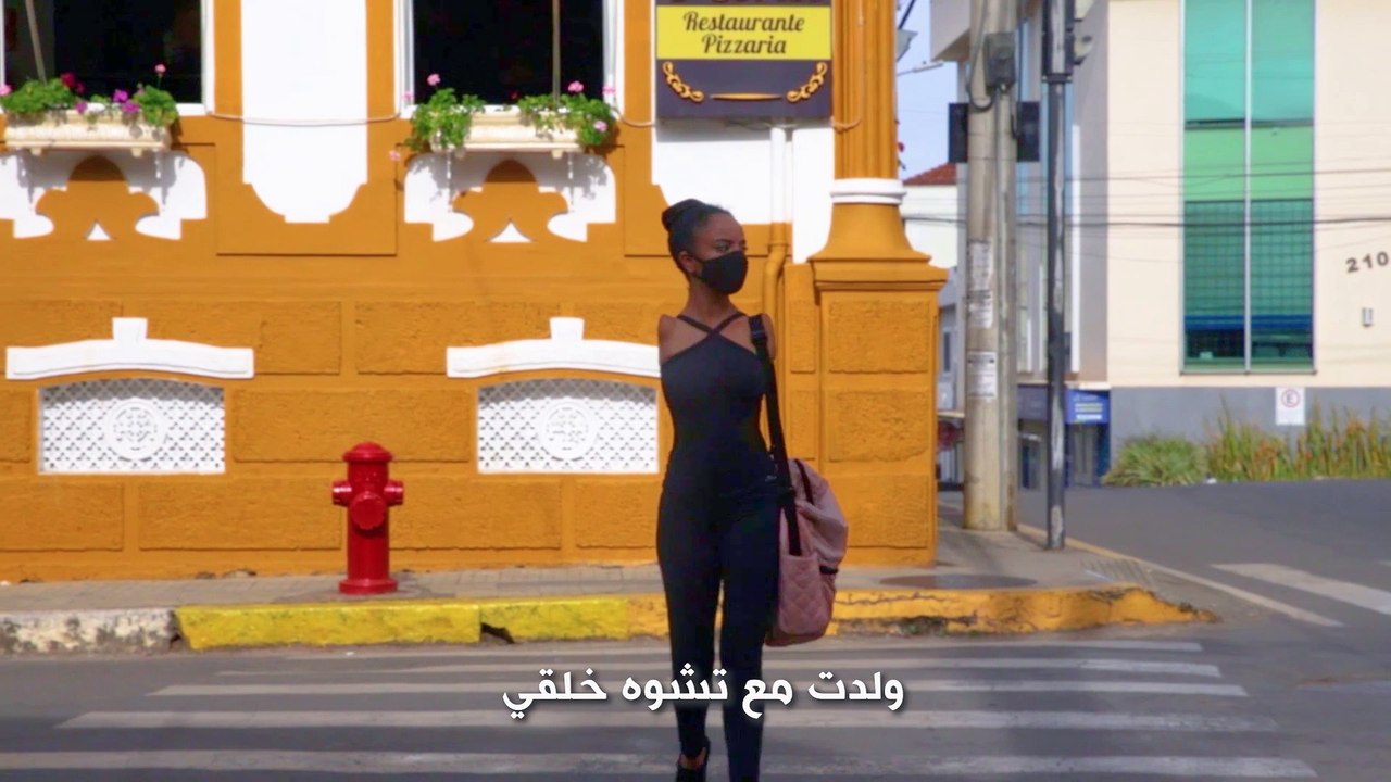 حياة لنعيشها: راقصة باليه بدون ذراعين تصبح مصدر إلهام