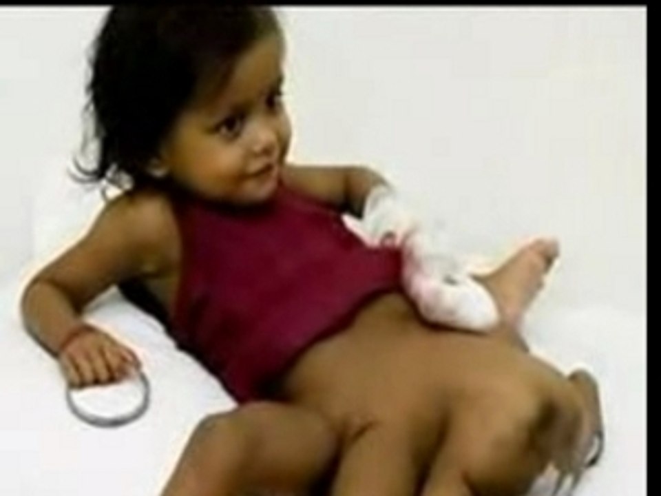 Bébé à 8 jambes