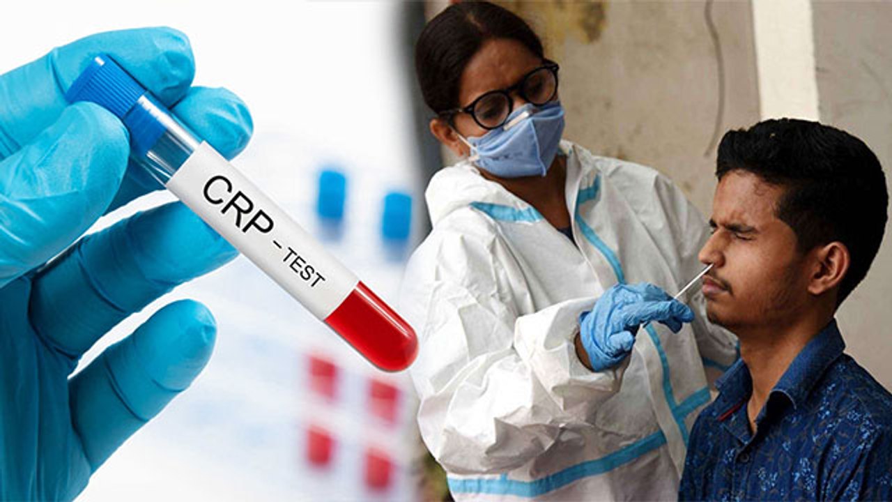 Coronavirus में क्यों कराया जा रहा है CRP Test, बढ़ गई है इस Test की मांग | Boldsky