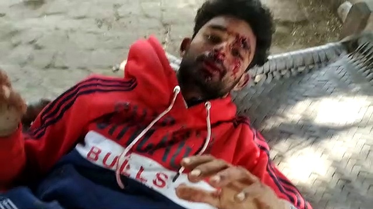 सड़क पर गड्ढे दे रहे हैं हादसों को दावत