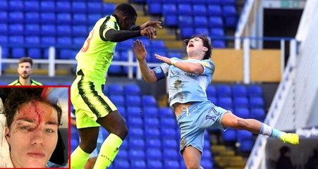 Rakibiyle çarpışan Coventry forması giyen Callum O'Hare, alnı yarıldığı halde oyundan çıkmadı