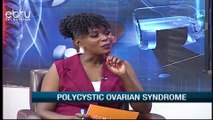 Signs & Symptoms Of Polycystic Ovarian Syndrome