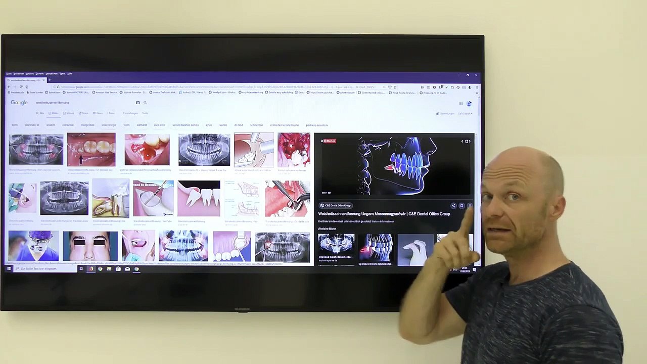 nach Weisheitszahn OP verlier ich den Zahn davor  - wieso