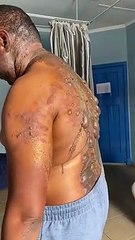 Urgent: Très jalouse, une femme jette de l'huile bouillante sur son mari