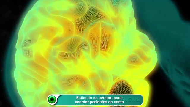 Estímulo no cérebro pode acordar pacientes do coma