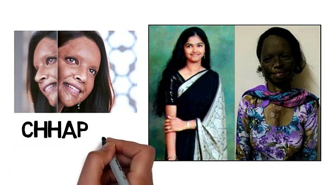 Chhapaak Movie The Untold Real Story Deepika Padukone Acid Attack Survivor (Laxmi Agrawal)