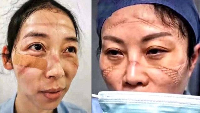 Çin'deki koronavirüs salgını bu kez sağlık görevlilerini vurdu! 1716 kişiye bulaştı, 6 kişi öldü