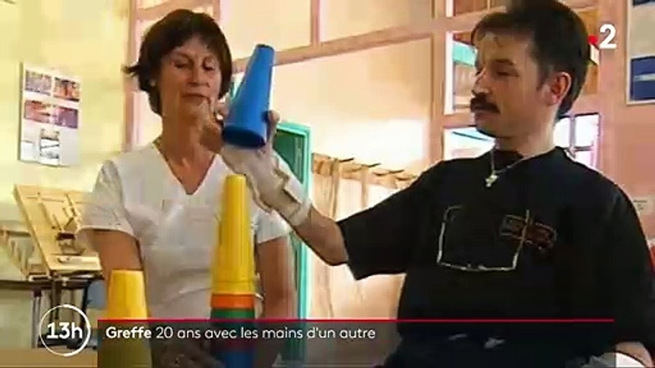 Santé : la première greffe des deux mains fête ses 20 ans