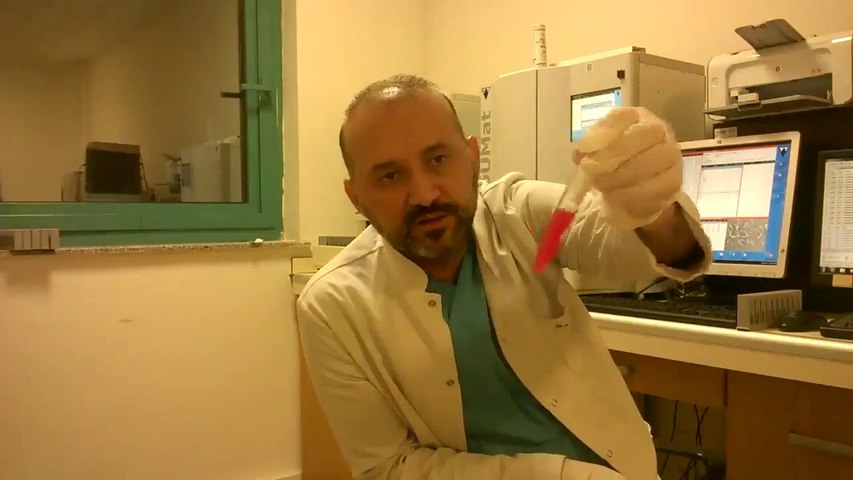 mikroskopla kum doken bir hastanin idrarini inceliyoruz uzmanindan tavsiyeler dailymotion video