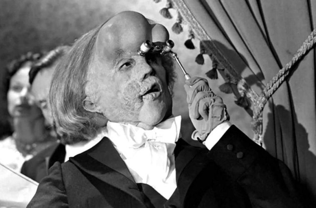 ELEPHANT MAN Film