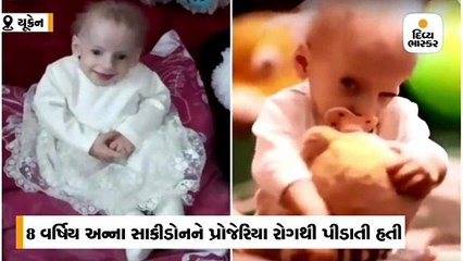 8 વર્ષની બાળકી ઘરડી થઈને મરી ગઈ,આ કેવી બિમારી ?