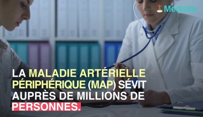 Maladie artérielle périphérique : 3 tasses de cacao par jour pourraient vous soulager