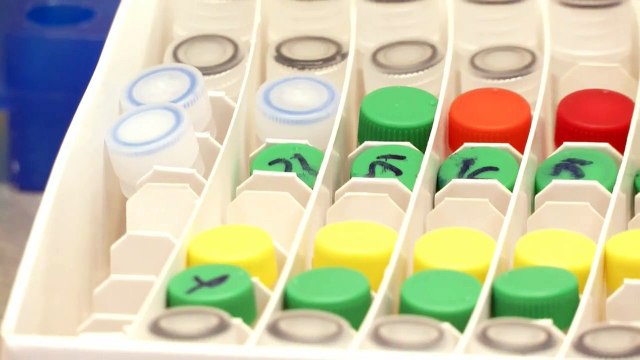 Koronavirüs için tanı kiti