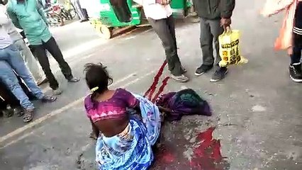 Download Video: ट्रक ने बाइक सवार को मारी टक्कर, 1 महिला गम्भीर रूप से घायल