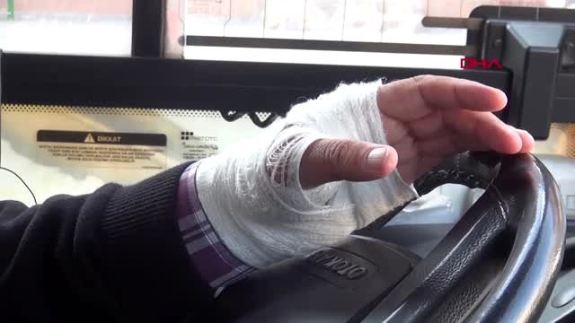 Niğde otobüs şoförü 'yol verme' kavgasında darp edildi - 2