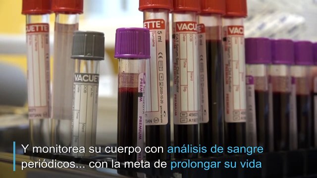 El biohacking gana cada vez más adeptos en Rusia